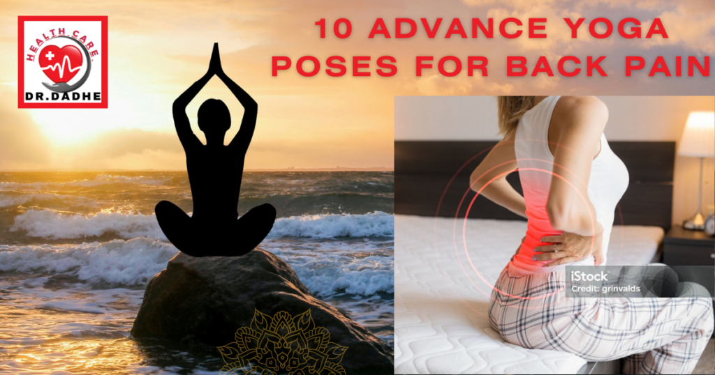 10 Advance Yoga Poses for Back Pain